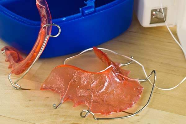 Orthodontic Retainer